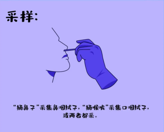采樣：捅鼻子采集鼻咽拭子,，捅喉嚨采集口咽拭子,，或兩者都采集。