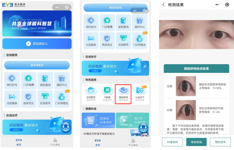 愛(ài)爾眼科互聯(lián)網(wǎng)醫(yī)院小程序“眼瞼腫物智能篩查”。